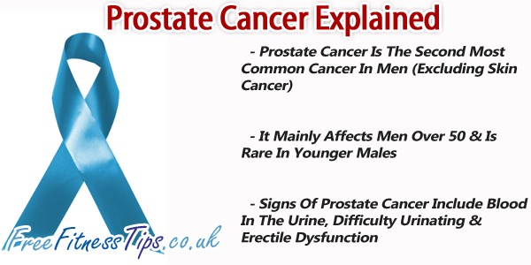 Prostate Cancer Explained