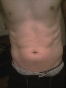 A front shot of my abs after completing the Slendertone 6 Week Plan.