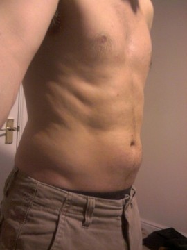 A right photo of my abs before starting the Slendertone 6 Week Plan.