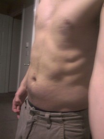A left shot of my abs before starting the Slendertone 6 Week Plan.