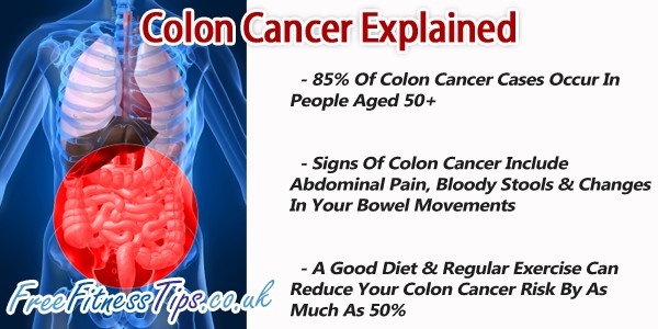 Colon Cancer Explained