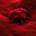 A cancerous tumour.